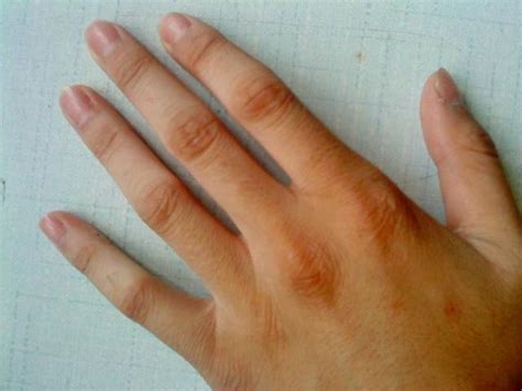 手指關節紋 姜树